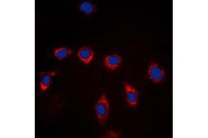 Immunofluorescent analysis of CD157 staining in Raw264. (BST1 Antikörper  (Center))