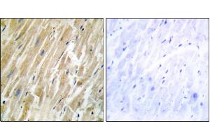Immunohistochemistry analysis of paraffin-embedded human heart tissue using CALR antibody. (Calreticulin Antikörper)