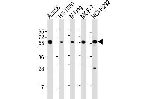 Western Blot at 1:2000 dilution Lane 1: A2058 whole cell lysate Lane 2: HT-1080 whole cell lysate Lane 3: mouse lung lysate Lane 4: MCF-7 whole cell lysate Lane 5: NCI-H292 whole cell lysate Lysates/proteins at 20 ug per lane. (MMP14 Antikörper  (N-Term))