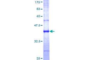 Caveolin 3 Protein (CAV3) (AA 1-83) (GST tag)