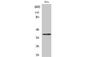 Western Blotting (WB) image for anti-Very-Long-Chain Enoyl-CoA Reductase-Like (LOC101508101) (Internal Region) antibody (ABIN3187049)
