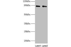 Western blot All lanes: CFB antibody at 2 μg/mL Lane 1: K562 whole cell lysate Lane 2: HepG2 whole cell lysate Secondary Goat polyclonal to rabbit IgG at 1/10000 dilution Predicted band size: 86, 69 kDa Observed band size: 86 kDa (Complement Factor B Antikörper  (AA 26-751))