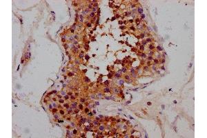IHC image of ABIN7168374 diluted at 1:300 and staining in paraffin-embedded human testis tissue performed on a Leica BondTM system. (MEX3B Antikörper  (AA 253-375))