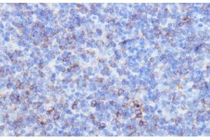 Immunohistochemistry of paraffin-embedded Mouse spleen using NOTCH3 Polyclonal Antibody at dilution of 1:100 (40x lens). (NOTCH3 Antikörper)