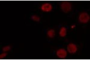 ABIN6274460 staining HeLa cells by IF/ICC. (CELF1 Antikörper  (N-Term))