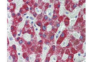 Anti-ACADS antibody IHC of human liver.