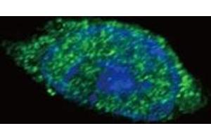 Confocal immunofluorescent analysis of JAK2 antibody with HeLa cells followed by Alexa Fluor 488-conjugated goat anti-rabbit lgG (green).