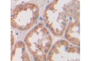 Used in DAB staining on fromalin fixed paraffin- embedded kidney tissue (Parkin Antikörper  (AA 229-465))