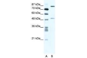 MMP10 antibody (20R-1313) used at 0. (MMP10 Antikörper  (N-Term))