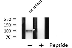 Western blot analysis of extracts from Rat spleen lysate, using LRP8 antibody. (LRP8 Antikörper  (Internal Region))