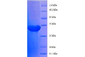 50S Ribosomal Protein L29 (AA 1-63), (full length) protein (GST tag)