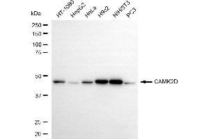 Western blotting analysis using CAMK2D antibody (ABIN7797835). (Rekombinanter CAMK2D Antikörper)