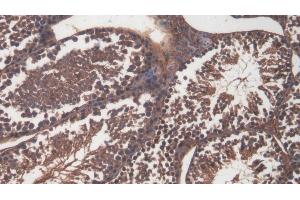 Detection of CD99 in Mouse Testis Tissue using Polyclonal Antibody to Cluster Of Differentiation 99 (CD99)
