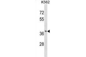 Western Blotting (WB) image for anti-Single-Strand-Selective Monofunctional Uracil-DNA Glycosylase 1 (SMUG1) antibody (ABIN2999446) (SMUG1 Antikörper)
