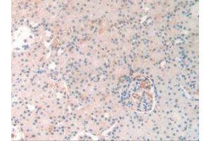 IHC-P analysis of Rat Kidney Tissue, with DAB staining. (SERPINA10 Antikörper  (AA 278-425))