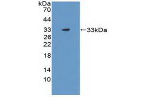 Western blot analysis of recombinant Rat CIDEC. (CIDEC Antikörper  (AA 1-221))