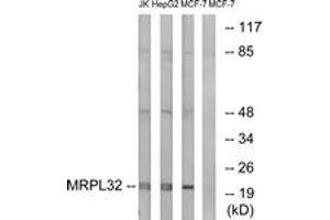 Western Blotting (WB) image for anti-Mitochondrial Ribosomal Protein L32 (MRPL32) (AA 101-150) antibody (ABIN2890054) (MRPL32 Antikörper  (AA 101-150))