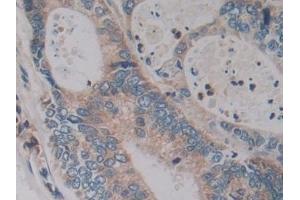 Immunohistochemistry (IHC) image for anti-Kallikrein 2 (KLK2) (AA 19-261) antibody (ABIN7435352)