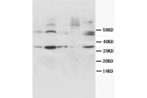 Western Blotting (WB) image for anti-Cyclin D1 (CCND1) antibody (ABIN1106872) (Cyclin D1 Antikörper)