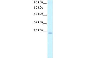 WB Suggested Anti-POLE3 Antibody Titration:  2. (POLE3 Antikörper  (N-Term))