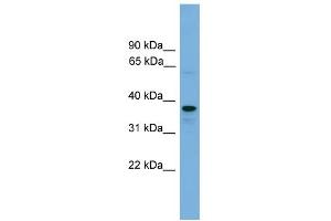 WB Suggested Anti-VPS16 Antibody Titration: 0. (VPS16 Antikörper  (N-Term))