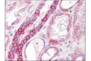 Human Kidney: Formalin-Fixed, Paraffin-Embedded (FFPE) (ST6GAL1 Antikörper  (Internal Region))