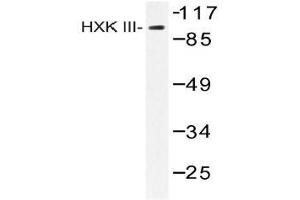 Western blot (WB) analysis of HXK III antibody in extracts from Jurkat insulin 0. (HK3 Antikörper)