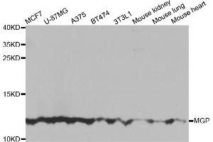 Western blot analysis of extracts of various cell lines, using MGP antibody (ABIN5975376) at 1/1000 dilution. (MGP Antikörper)