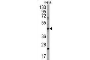 Western Blotting (WB) image for anti-Chitinase Domain Containing 1 (CHID1) antibody (ABIN2999239) (CHID1 Antikörper)