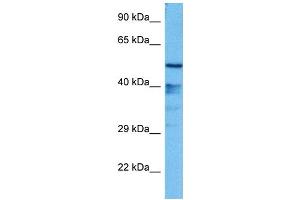 Host:  Mouse  Target Name:  GFI1  Sample Tissue:  Mouse Liver  Antibody Dilution:  1ug/ml (GFI1 Antikörper  (N-Term))
