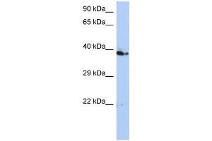 WB Suggested Anti-C10orf46 Antibody Titration: 0. (CACUL1 Antikörper  (Middle Region))