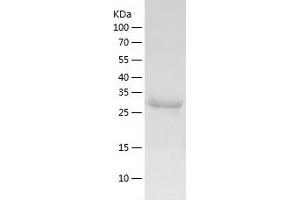 Western Blotting (WB) image for Cyclin-Dependent Kinase 16 (CDK16) (AA 158-496) protein (His tag) (ABIN7122526) (CDK16 Protein (AA 158-496) (His tag))