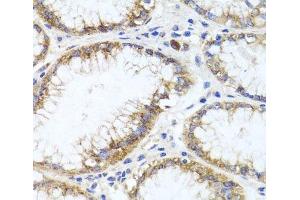 Immunohistochemistry of paraffin-embedded Human stomach using GPM6A Polyclonal Antibody at dilution of 1:100 (40x lens). (GPM6A Antikörper)