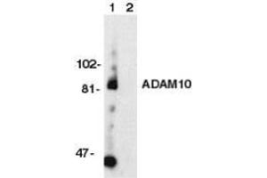 Western blot analysis of ADAM10 in Jurkat whole cell lysate with ADAM10 antibody at 1ug/ml Immunocytochemistry: use at 1-5ug/ml (ADAM10 Antikörper)