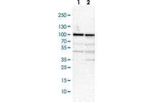 Western blot analysis of Lane 1: NIH-3T3 cell lysate (Mouse embryonic fibroblast cells) Lane 2: NBT-II cell lysate (Rat Wistar bladder tumour cells) with RPS6KA3 polyclonal antibody  at 1:100-1:250 dilution. (RPS6KA3 Antikörper)