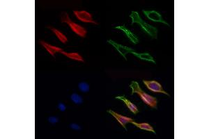 ABIN6257028 and ABIN6275977 staining Hela cells by IF/ICC. (CCZ1B Antikörper  (N-Term))