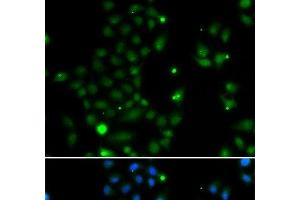 Immunofluorescence analysis of MCF-7 cells using GCM1 Polyclonal Antibody (GCM1 Antikörper)