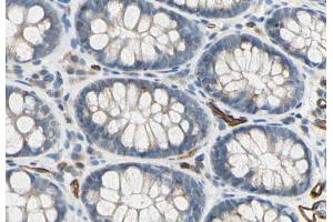 ABIN6278318 at 1/100 staining human colon    sections by IHC-P. (CD93 Antikörper  (C-Term))