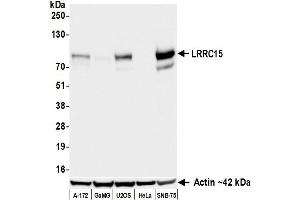 Western Blotting (WB) image for anti-Leucine Rich Repeat Containing 15 (LRRC15) (AA 22-538) antibody (ABIN7795790)