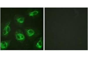 Immunofluorescence analysis of HeLa cells, using Calsenilin/KCNIP3 (Ab-63) Antibody.