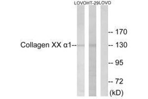 Western blot analysis of extracts from HUVEC cells, using Collagen XX α1 antibody. (COL2A1 Antikörper  (C-Term))