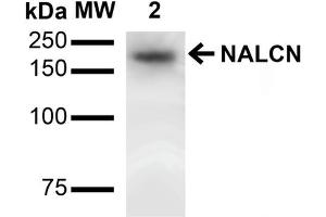 Western Blot analysis of Rat Brain showing detection of ~200 kDa NALCN protein using Mouse Anti-NALCN Monoclonal Antibody, Clone S187-7 . (NALCN Antikörper  (AA 1659-1738) (PE))