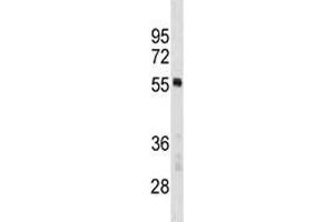 PTBP1 antibody western blot analysis in MCF-7 lysate. (PTBP1 Antikörper  (AA 26-55))