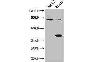 Western Blot Positive WB detected in: HepG2 whole cell lysate, Mouse brain tissue All lanes: FIGN antibody at 3 μg/mL Secondary Goat polyclonal to rabbit IgG at 1/50000 dilution Predicted band size: 83 kDa Observed band size: 83, 38 kDa (Fidgetin Antikörper  (AA 132-371))