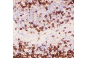 Immunohistochemistry (IHC) image for anti-CD3 epsilon (CD3E) (AA 23-207) antibody (ABIN3043805)