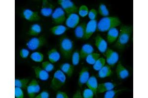 IF analysis of HSPA6 using anti-HSPA6 antibody (ABIN7601944). (HSPA6 Antikörper  (AA 516-643))