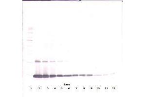 Image no. 2 for anti-Colony Stimulating Factor 2 (Granulocyte-Macrophage) (CSF2) antibody (ABIN465581)