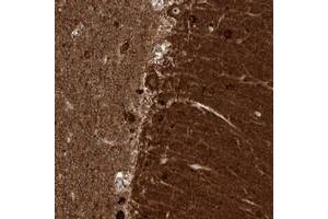 Immunohistochemical staining of human cerebellum with ZNF512 polyclonal antibody  shows strong cytoplasmic and nucleolar positivity in Purkinje cells. (ZNF512 Antikörper)