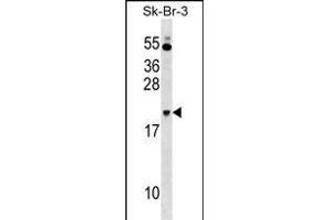 NKIRAS1 Antibody (Center) (ABIN1538446 and ABIN2849067) western blot analysis in SK-BR-3 cell line lysates (35 μg/lane). (NKIRAS1 Antikörper  (AA 48-76))