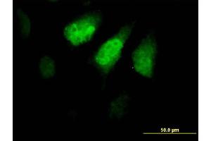 Immunofluorescence of purified MaxPab antibody to ZNF259 on HeLa cell. (ZNF259 Antikörper  (AA 1-459))